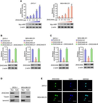 ZKSCAN5 Activates VEGFC Expression by Recruiting SETD7 to Promote the Lymphangiogenesis, Tumour Growth, and Metastasis of Breast Cancer